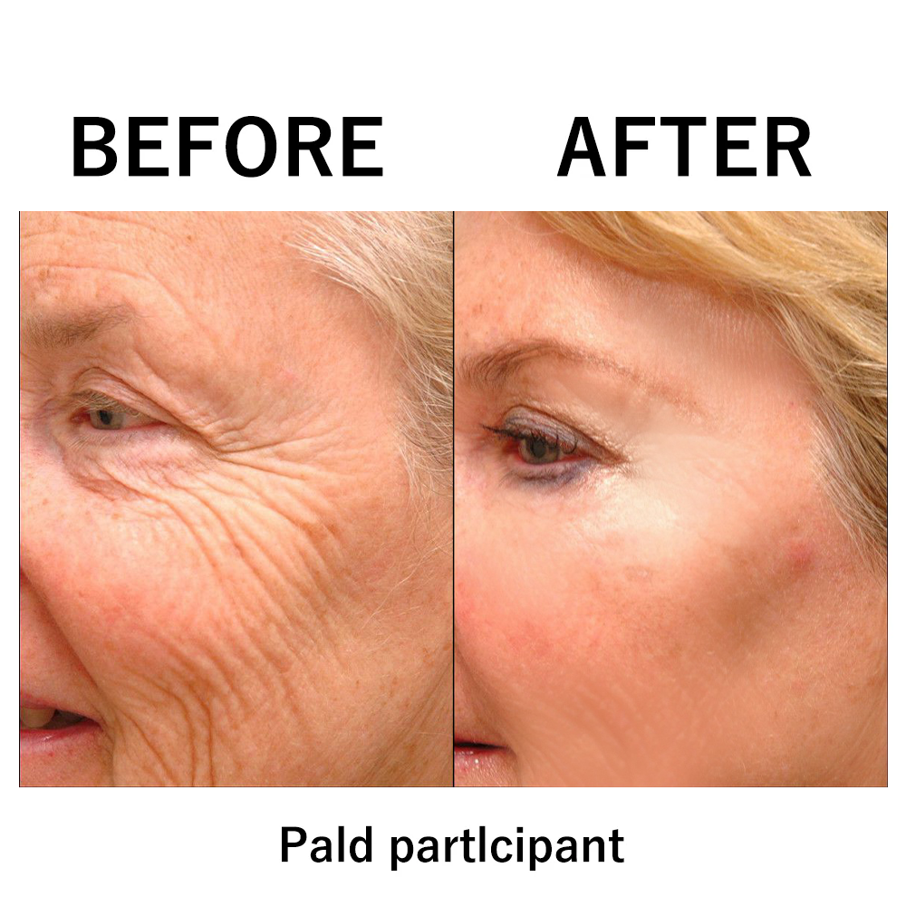 [Official Brand Store]💖✨Furzero® Lift & Firm Instant Skin Tightener