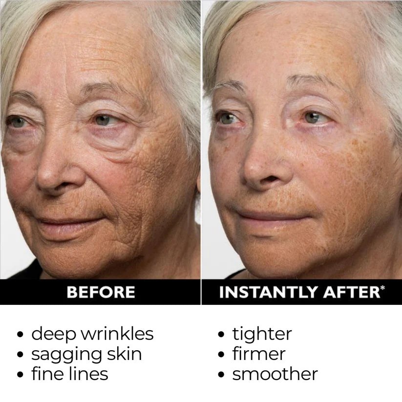[Official Brand Store]💖✨Furzero® Lift & Firm Instant Skin Tightener