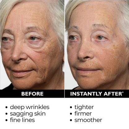 [Official Brand Store]💖✨Furzero® Lift & Firm Instant Skin Tightener