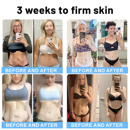 💖🩷Flysmus™ Collagen Peptides  FIRMING SERUM STICK
